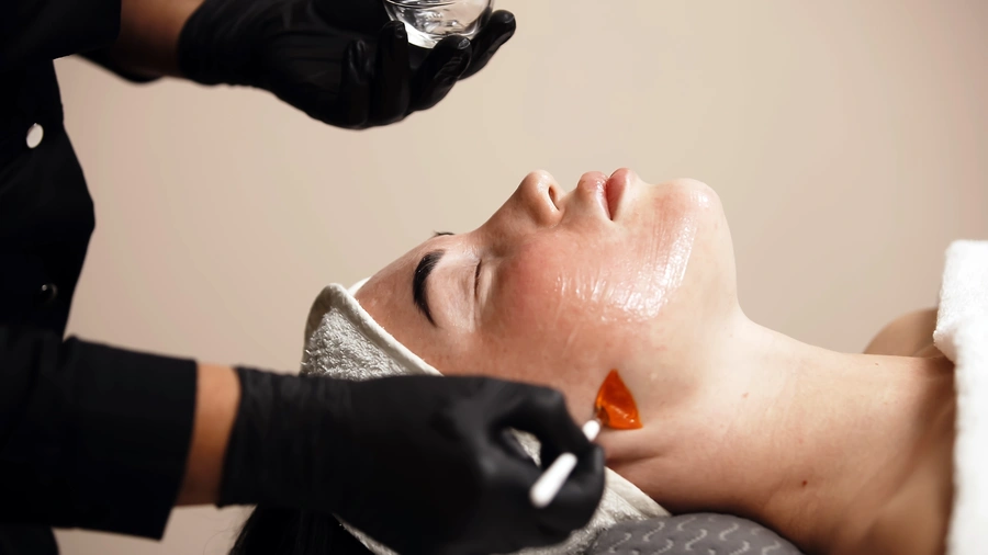 Why Facial Treatments Reduce Razor Burn And Irritation in Raleigh, NC